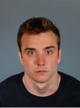 Calum McSwiggen in a photo taken at the West Hollywood Sheriff's Station after he was booked and before he assaulted himself. (Photo courtesy of the Los Angeles Sheriff's Department)